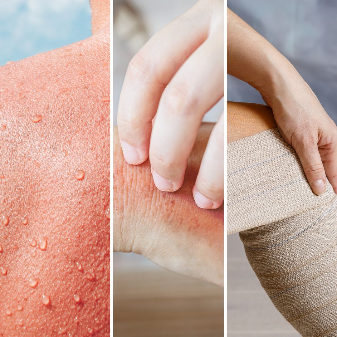 Marathon protege la piel dañada de la humedad y la fricción